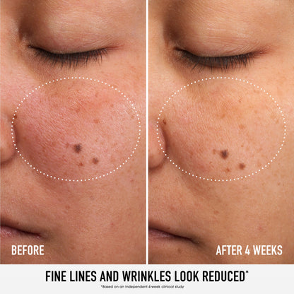 SKIN RESCUE Pure Smooth Serum with 5% Niacinamide and Chebula